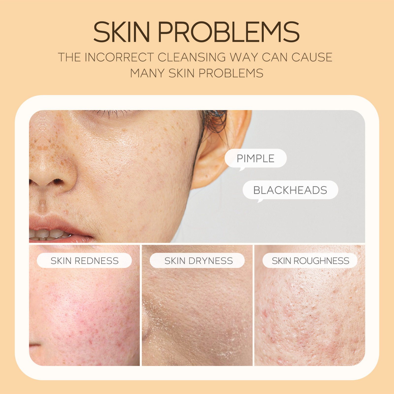 LAIKOU Vitamin C Facial Cleanser Skin Cleansing Moisturizing Blackhead Remove Skincare Face Wash Foam Face Skin Care