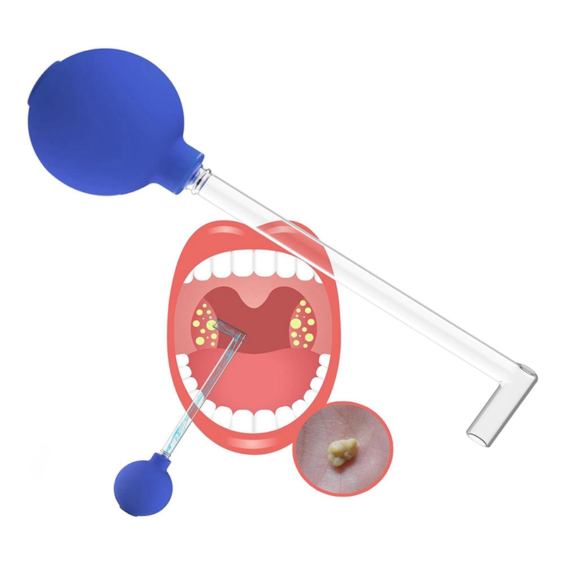 Tonsil Stone Remover Vacuum, Tonsil Stone Remover Kit, Tonsil Stone Removal Tool,Manual Style Mouth Cleaning Durable Easy To Use