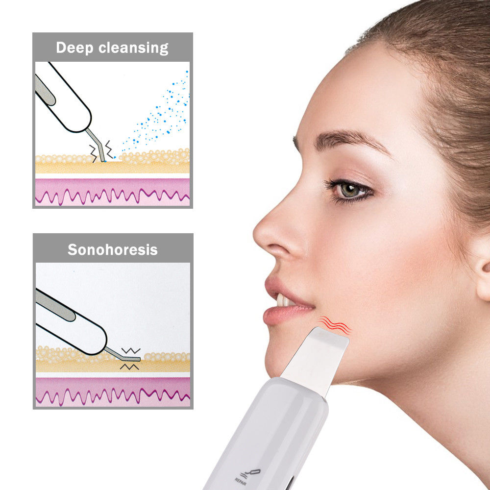 Ultrasonic Peeling Machine Skin Care Facial Cleanser Blackhead Cleaning Device EMS Microcurrent Ultrasonic Scrubber