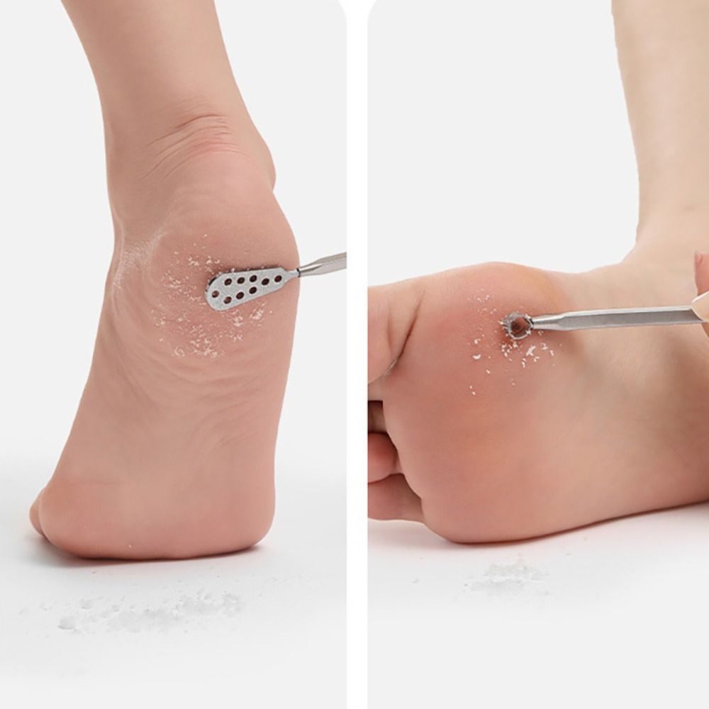 Scraper Exfoliating Callus Rasp File Foot Care Tools Cuticle Shaver Feet Pedicure File Toe Nail Scraper Manicure Pedicure Tools