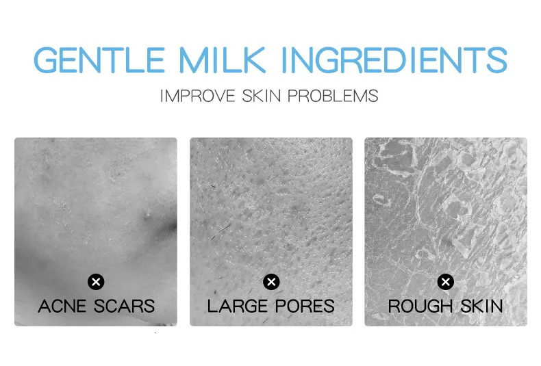 Milk Carem Anti Nourish Creams Beauty Aintenance Face Skin Care Korean Cosmetics X251117