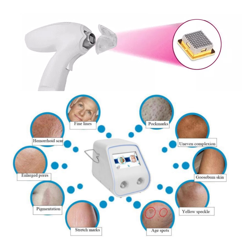 Newest Technology Novoxel Tixel 2 Thermal Fractional Mezotix Machine WithTwo Handle Pigment Scar Wrinkle Stretch Removal Machine