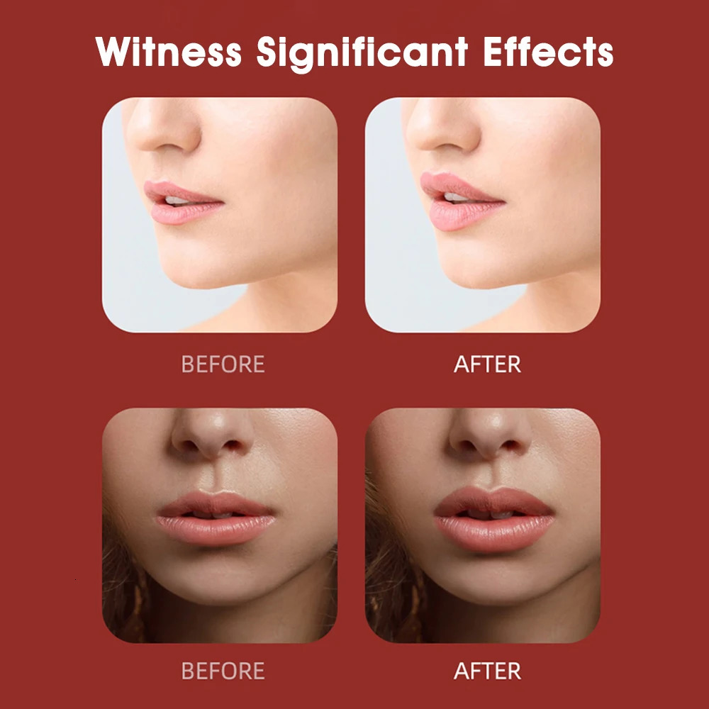 Silicone Lip Plumper Device Automatic Lip Plumper Electric Plumping Device Beauty Tool Fuller Bigger Thicker Lips for Women 240626