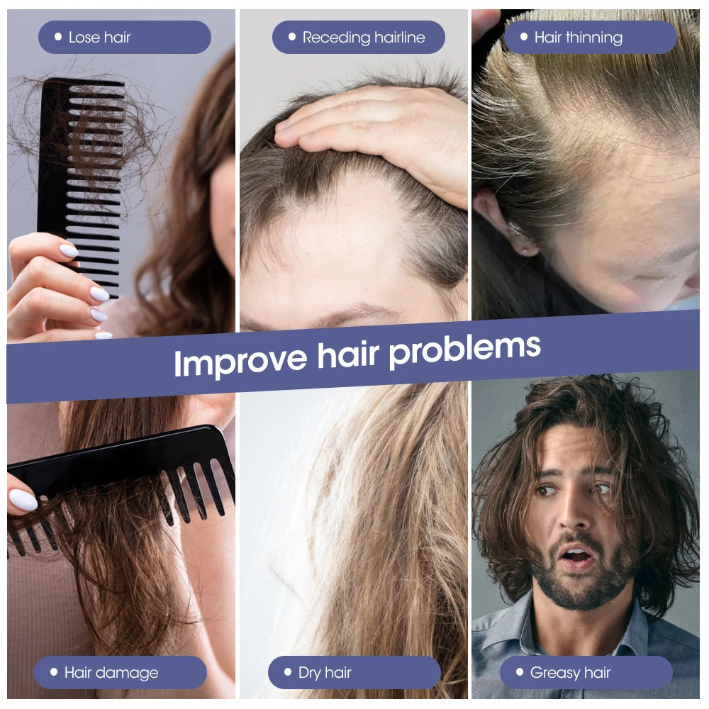 Tool Scalp Comb Red Blue Light Hair Care Scalp Massage Comb Head Massager Electric Hair Brush Electric Massage Comb 240626