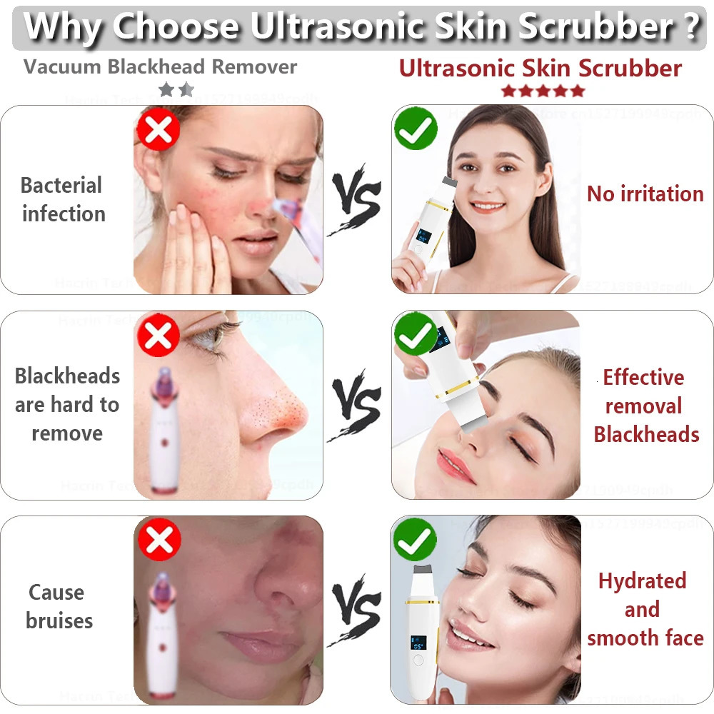 Ultrasonic Skin Scrubber Ultrasonic Peeling Scrubber Shovel Deep Cleaning Face Pore 240626
