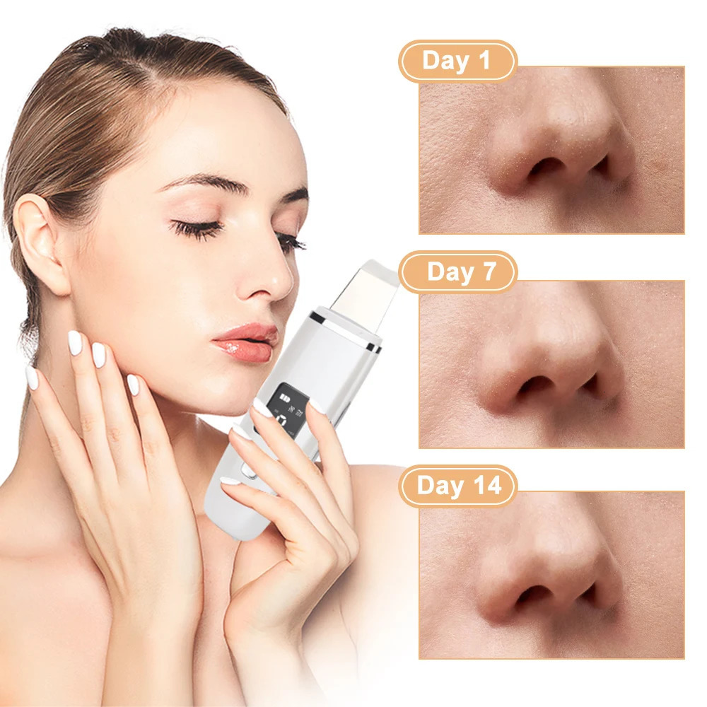 Ultrasonic Skin Scrubber Professional Deep Face Peeling Shovel Device Pore Cleaner Exfoliating Skin Scrubber Lift Machine 240626