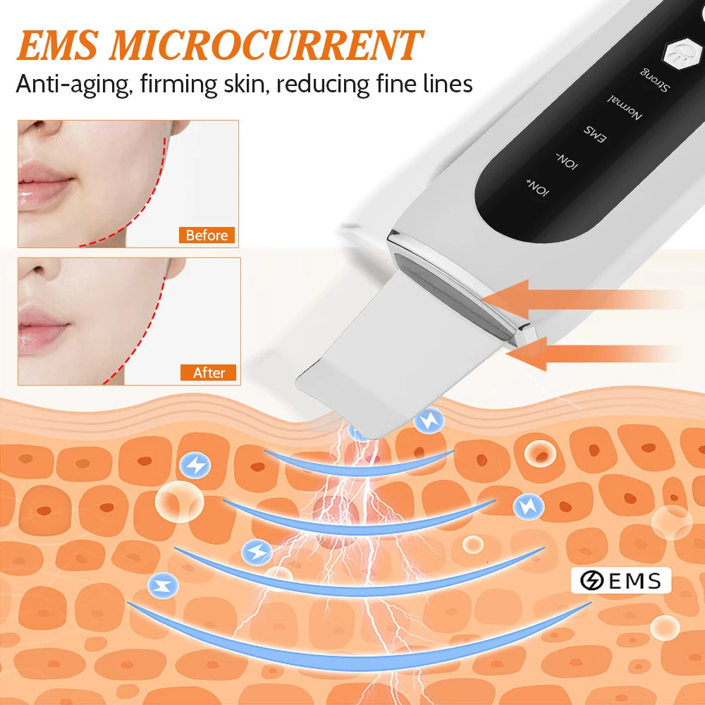 Ultrasonic Skin Scrubber Peeling Blackhead r Deep Face Cleaning Ultrasonic Ion Ance Pore Cleaner Shovel Device 240626