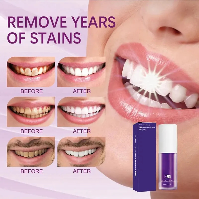 Toothpaste Purple Color Corrector Toothpaste For Teeth White Brightening Reduce Yellowing Tooth Care Toothpaste 30ml 240627