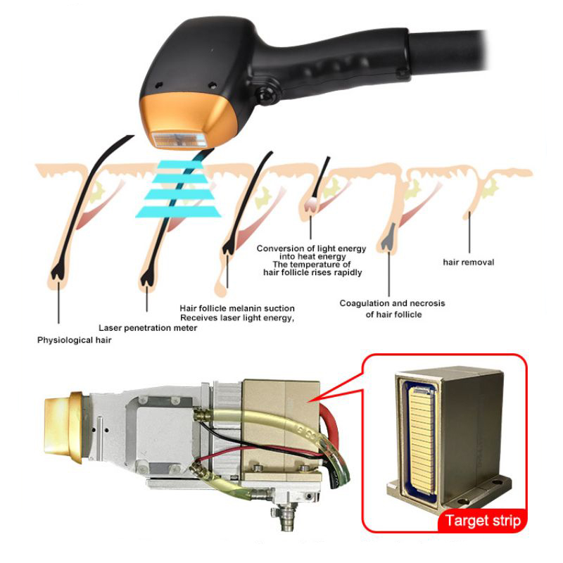 High-end 808nm Diode Laser Hair Removal 755nm 808nm 1064nm Ice Point Freezing 3500 Power Strong Penetration Hair Root Damage Depilation Machine
