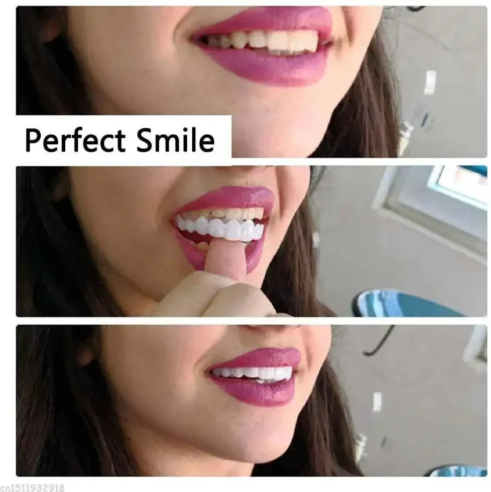 2Pcs Perfect Fit Teeth Whitening Fake Tooth Cover Snap On Silicone Smile Veneers Teeth Upper Beauty Tool 240627