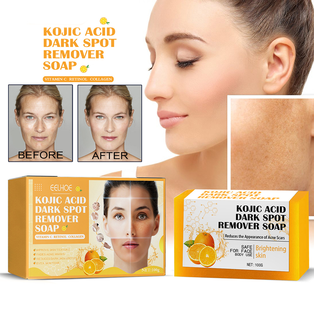 100g Brightening Turmeric Soap with Vitamin C E/Retinol/Turmeric/Olive Oil Vitamin C Soap for Acne/Dark Spots/Hyperpigmentation