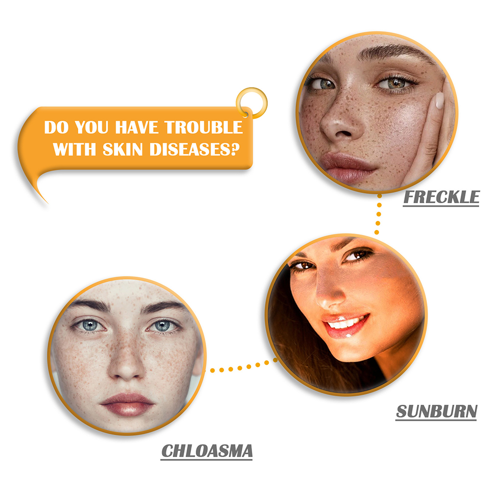 100g Brightening Turmeric Soap with Vitamin C E/Retinol/Turmeric/Olive Oil Vitamin C Soap for Acne/Dark Spots/Hyperpigmentation