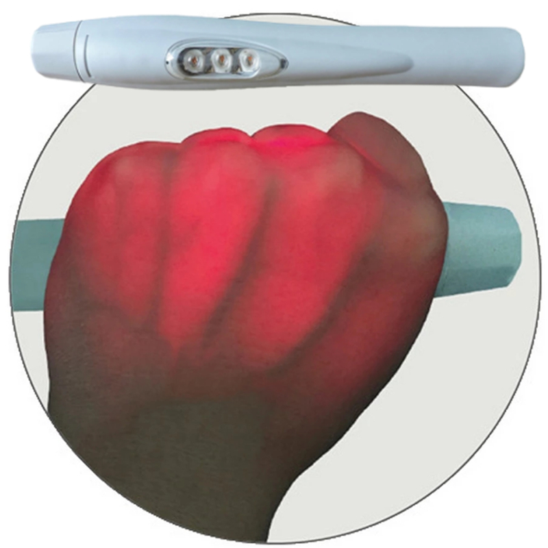 Portable nursing infrared vein finder medical Portable children vein illuminator vein Infrared Vein Locator