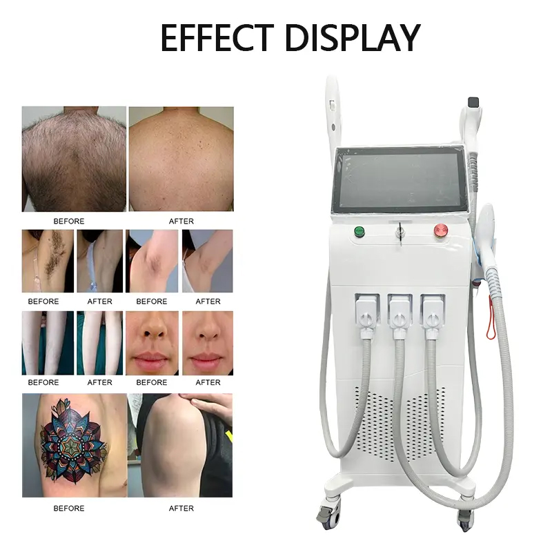 Newest 3 IN 1 Nd Yag Laser Tattoo Removal Beauty Device Fast Hair Removal With IPL Skin Rejuvenation Pigmentation Correctors Machine Equipment