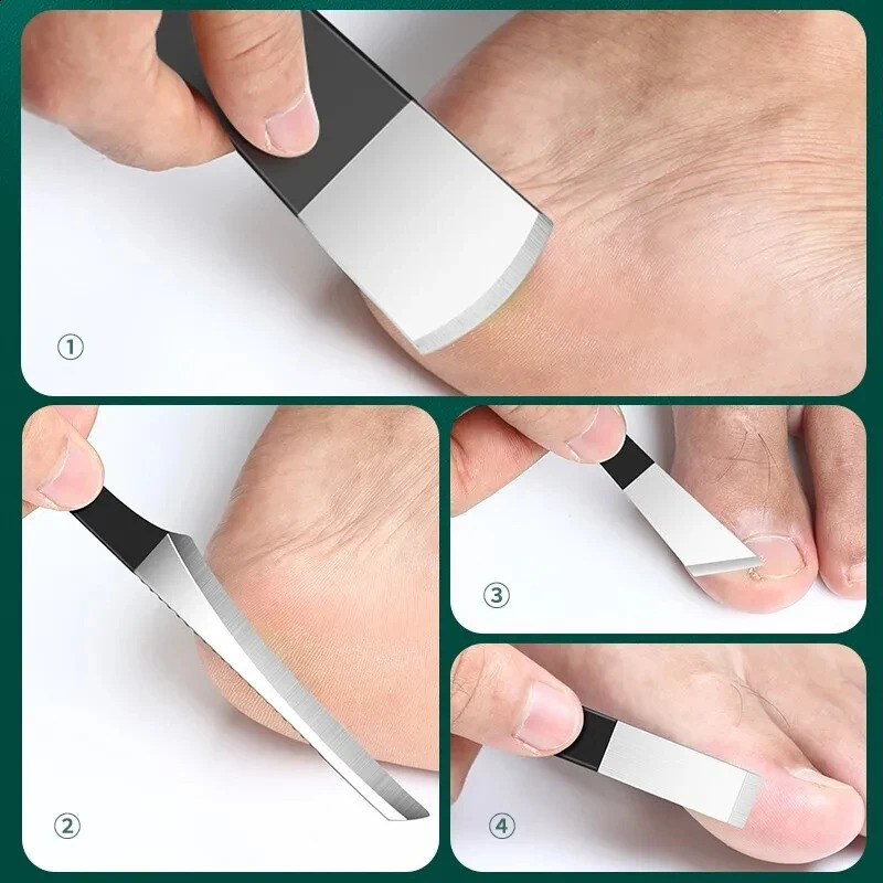 16pcs/set foot treatment kit Ingrown Toenail tool kit advanced nail treatment foot tool Ingrown Toenail removal scissors 240927