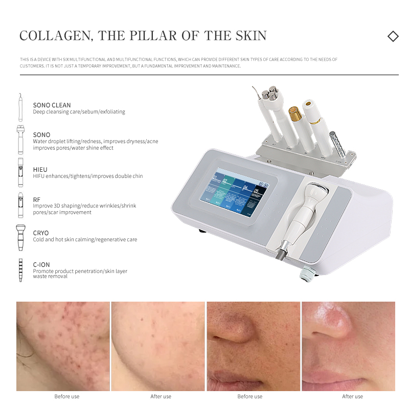 Multifunction 6 In 1 Face Lifting Treatment Tender Skin Brightens Skin Tone Improve Pores Acne Removal Beauty Equipment