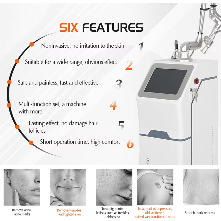 Trending Co2 Laser 10600nm New Fractional Dot Matrix Skin Remodeling Anti-aging for Wrinkle Removal Stretch Mark Remove Dermatology Equipment