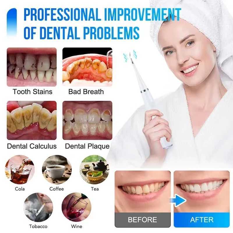 Rechargeable electric teeth cleaning tool white waterproof USB fast charging sonic toothbrush device M241017