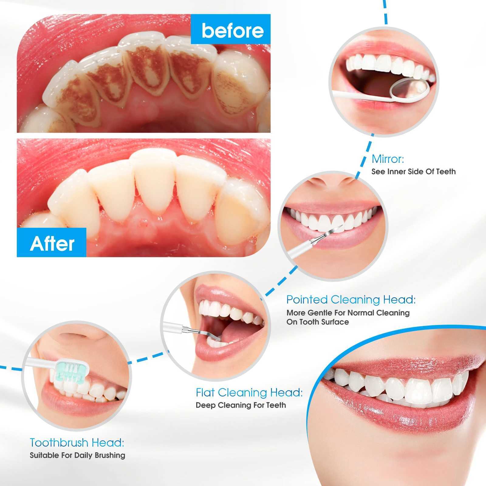 Ultrasonic electro acoustic wave dental scale dyeing Tatar calculus teeth whitening cleaning waterproof electric toothbrush M241017