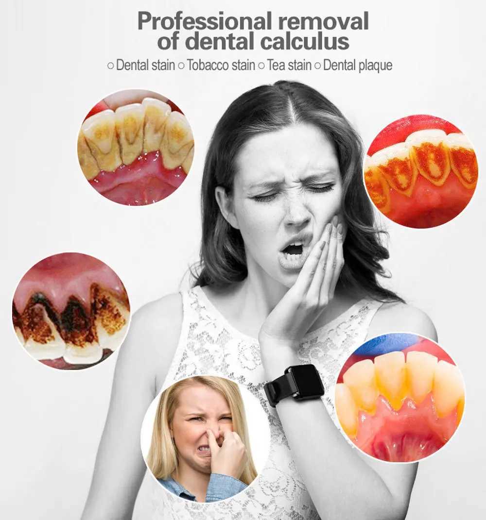 New electric dental calculus removal teeth cleaning equipment teeth cleaner teeth whitening and rinsing device Tatar scale removal M241017