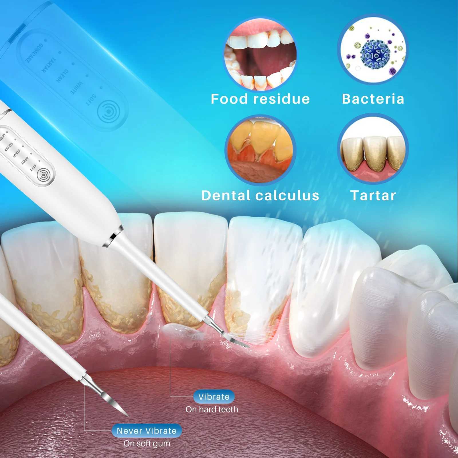 Ultrasonic electro acoustic wave dental scale dyeing Tatar calculus teeth whitening cleaning waterproof electric toothbrush M241017