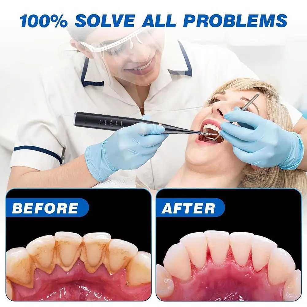 6-in-1 Ultrasonic Dental Cleaning Scale Dental Tartar Removal Electric Toothbrush Sonic Dental Plaque Cleaner M241017