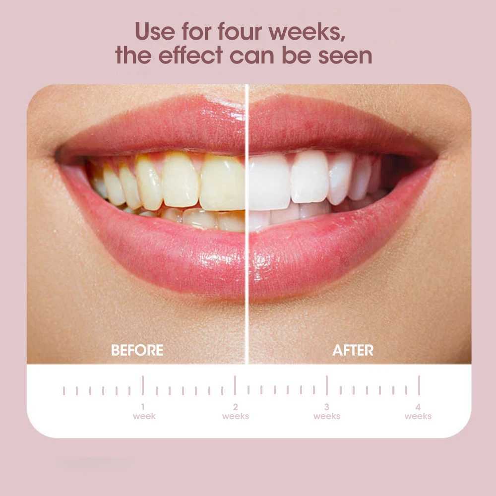 Sonic electric toothbrush IPX7 waterproof soft bristle cleaning whitening machine removes tartar color oral cleaning adult USB M241017