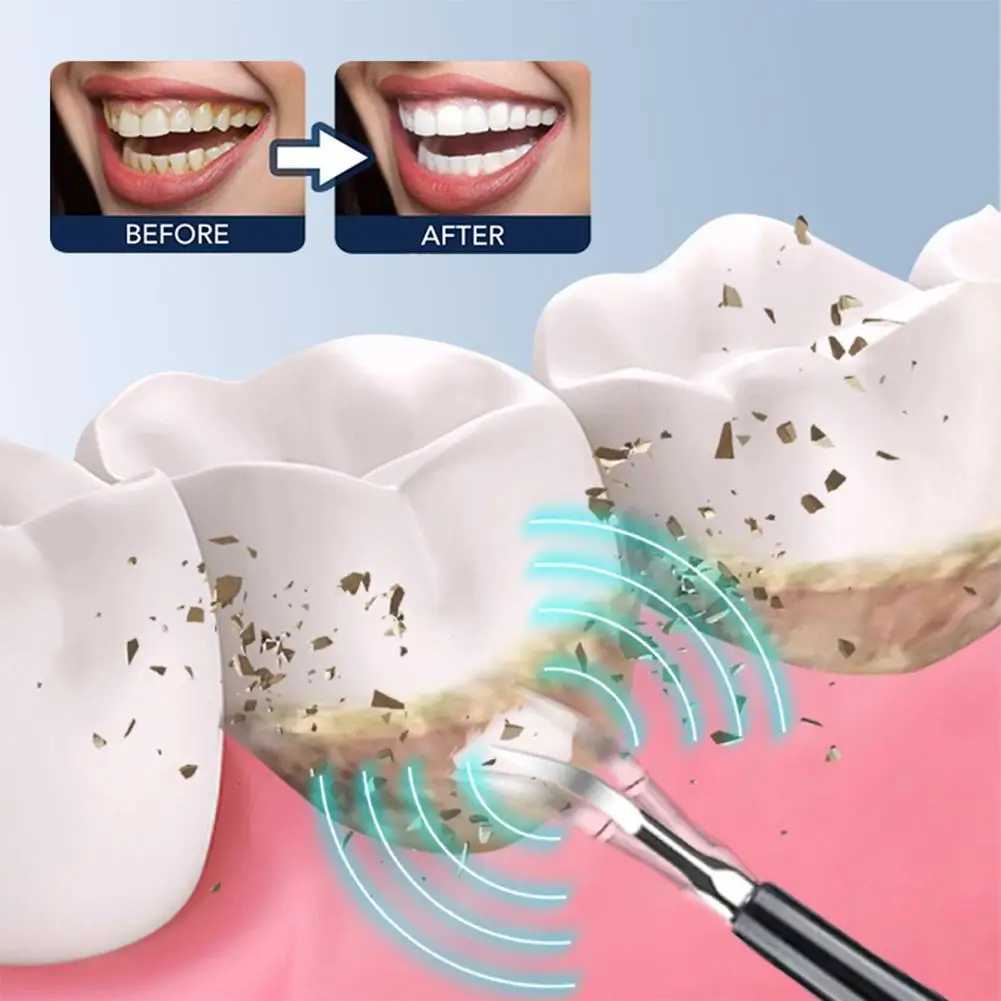 6-in-1 Ultrasonic Dental Cleaning Scale Dental Tartar Removal Electric Toothbrush Sonic Dental Plaque Cleaner M241017