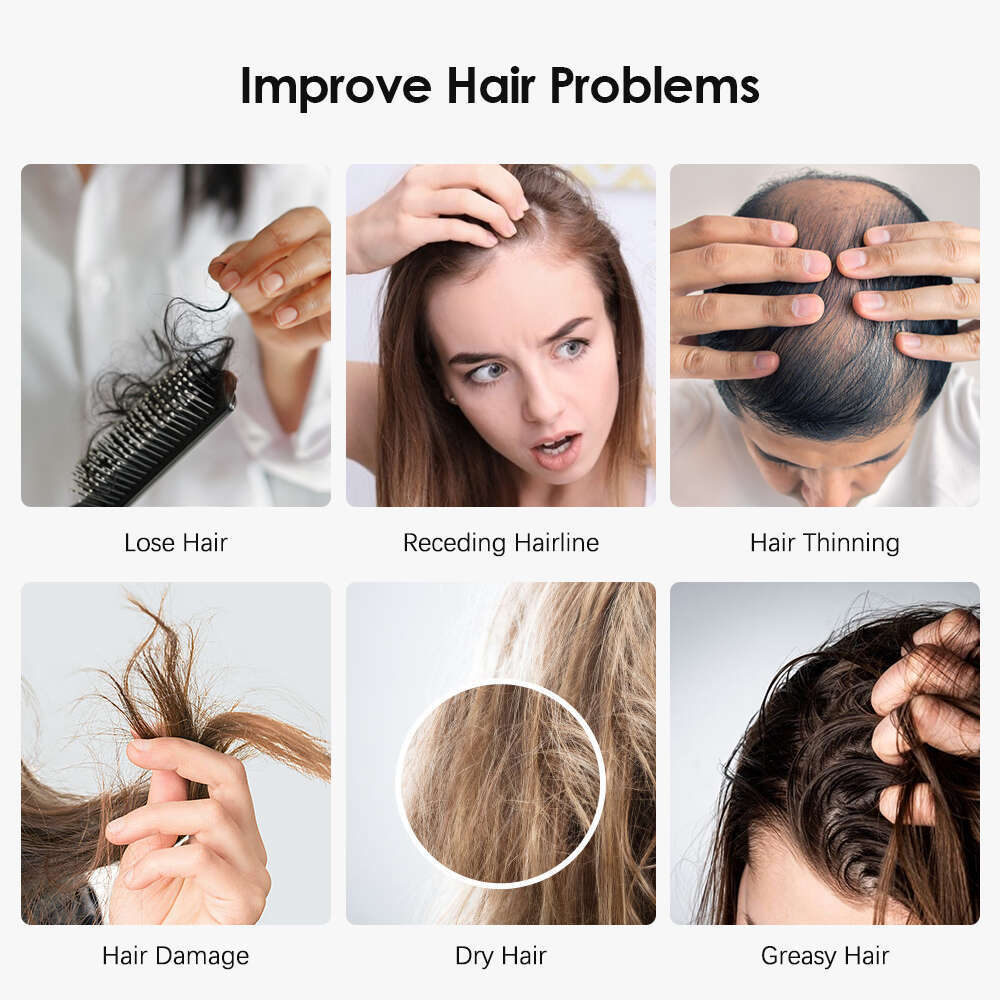 Electric Massage Comb Red Blue Light Therapy Vibration Growth Scalp Head Massager Anti Hair-Loss Negative Ion Hair Brush