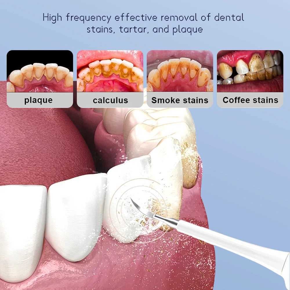 New Arrival Electric teeth cleaning instrument waterproof USB fast charging sonic toothbrush rechargeable dental brush device G241017