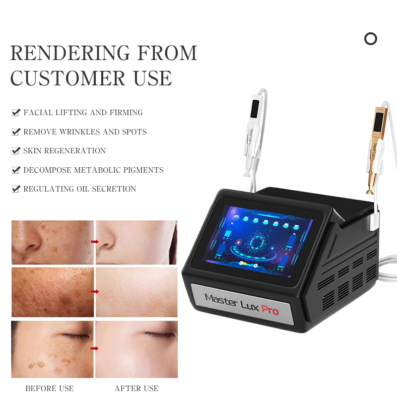 CE Approved 2 Handles Skin Restoration Ozone + Plasma Pen Skin Rejuvenation Face Contouring Firmness Increase Fibroblast Repairing Anti-bacteria Machi