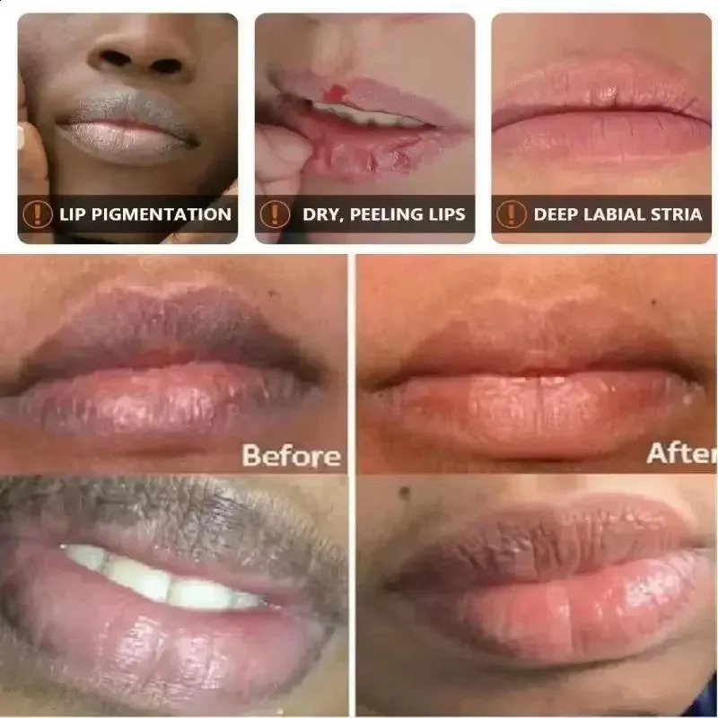 Remove dark lipstick whitening melanin facial mask gloss exfoliating lipstick pink treatment reduce lip line improve dry and moisturizing 241021