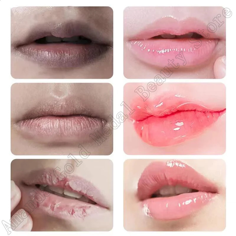 Removing dark lipstick whitening melanin lip gloss oil exfoliating cleaning moisturizing Korean care products beauty care 241021