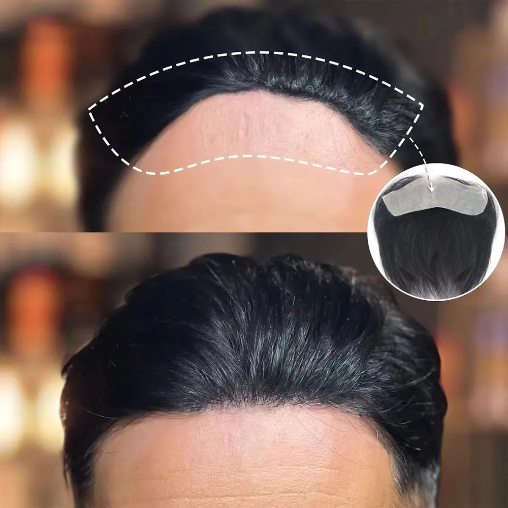 Mens Frontal Toupee V Loop 100% Human Hair Forehead Hairline Patch 0.06mm Thin Skin PU Hairline Mens Capillary Prosthesis 241102