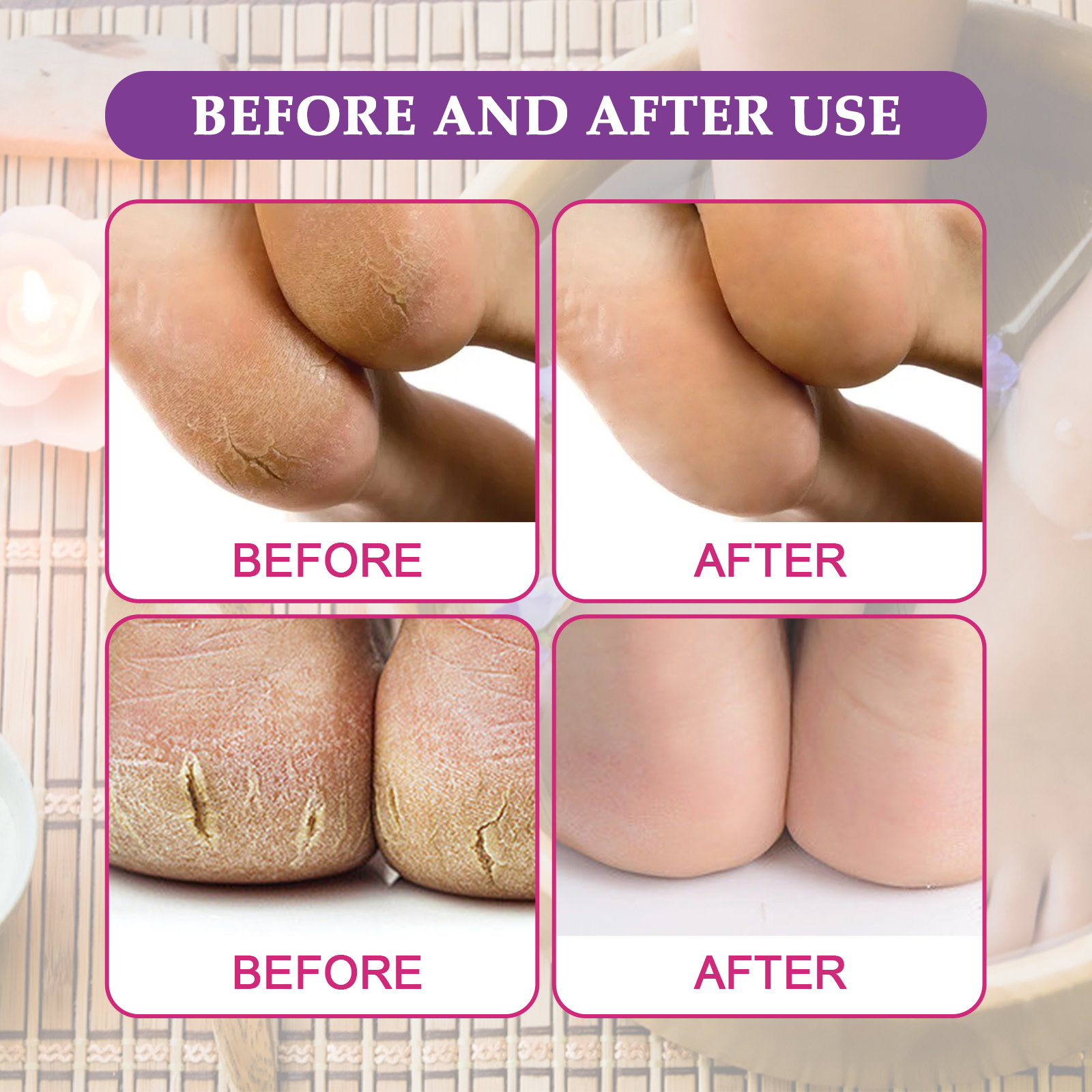 US Stock Deep Cleaning EELHOE Aromatherapy Foot Bath Salts Soothes Tired Feet & Promotes Healthy Circulation