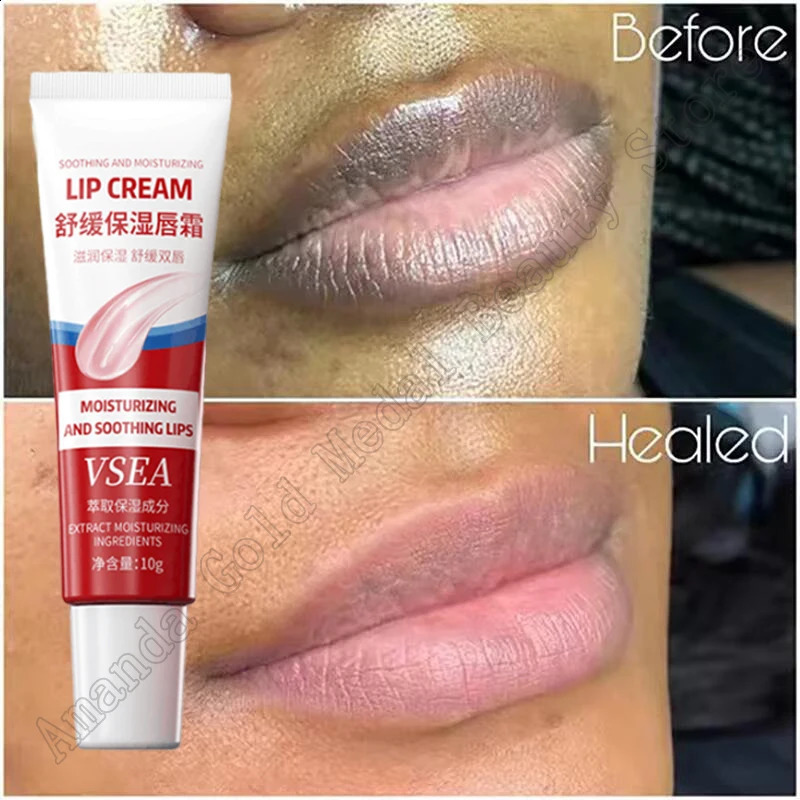 Remove dark lipstick fast whitening lipstick fade lip line dead skin moisturizing agent Korean care products beauty and health care 241021