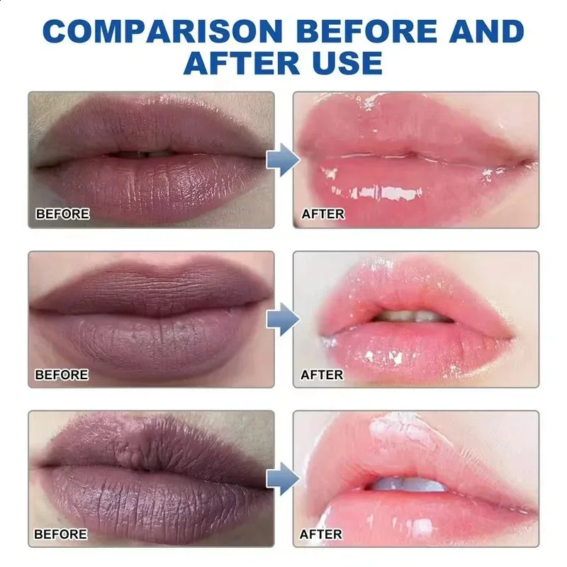 Remove dark lipstick fast whitening lipstick fade lip line dead skin moisturizing agent Korean care products beauty and health care 241021