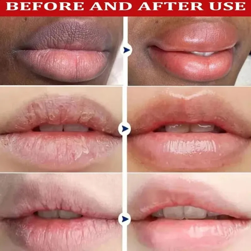 Remove dark lipstick whitening melanin facial mask gloss exfoliating lipstick pink treatment reduce lip line improve dry and moisturizing 241021