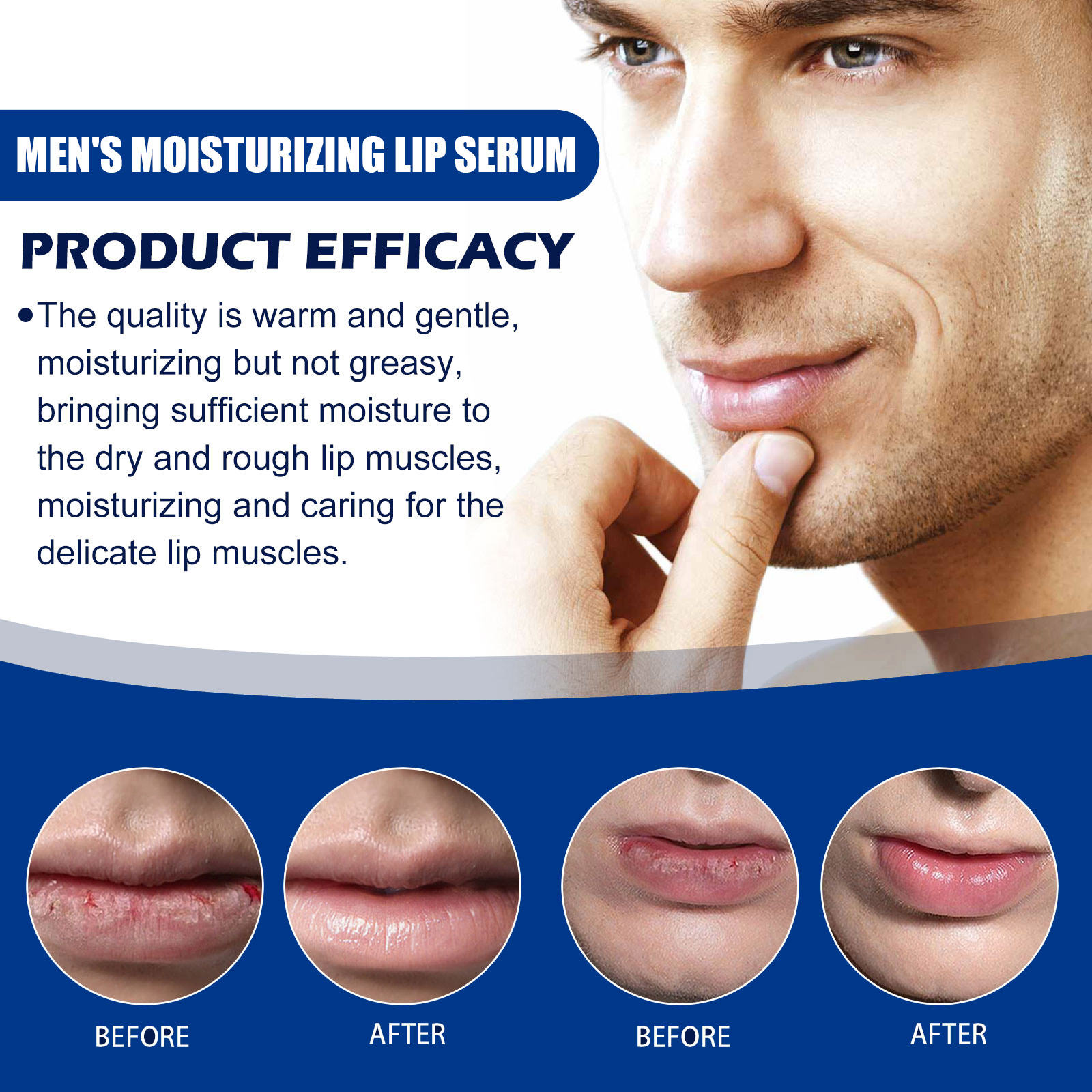 US Stock EAST MOON Lip Essence Roller Ball Liquid Nourishes and lightens lip lines, prevents dry, cracked and dead skin, plumps and moisturizes lips