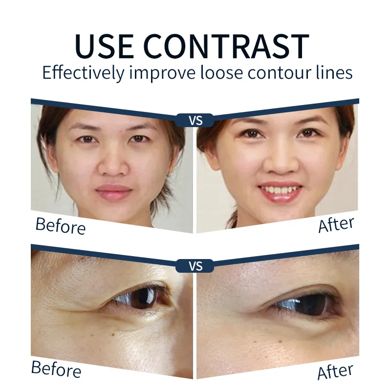 Korean Multi-functional skincare beauty device face lifting device for face lifting wrinkle removal