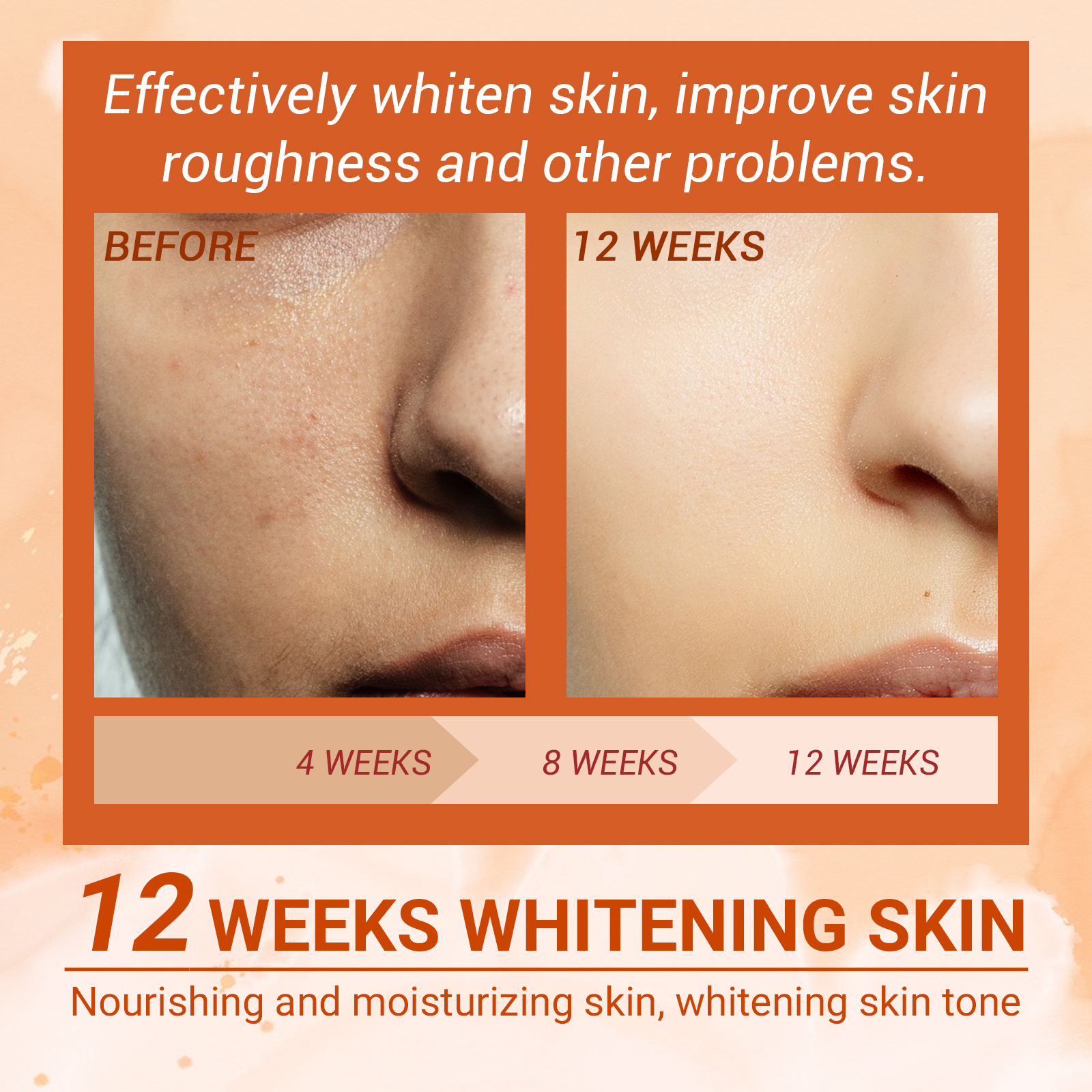 US Stock EELHOE Vitamin C Moisturizing Mist Hydrating and moisturizing skin acne blemish rejuvenating and whitening spray