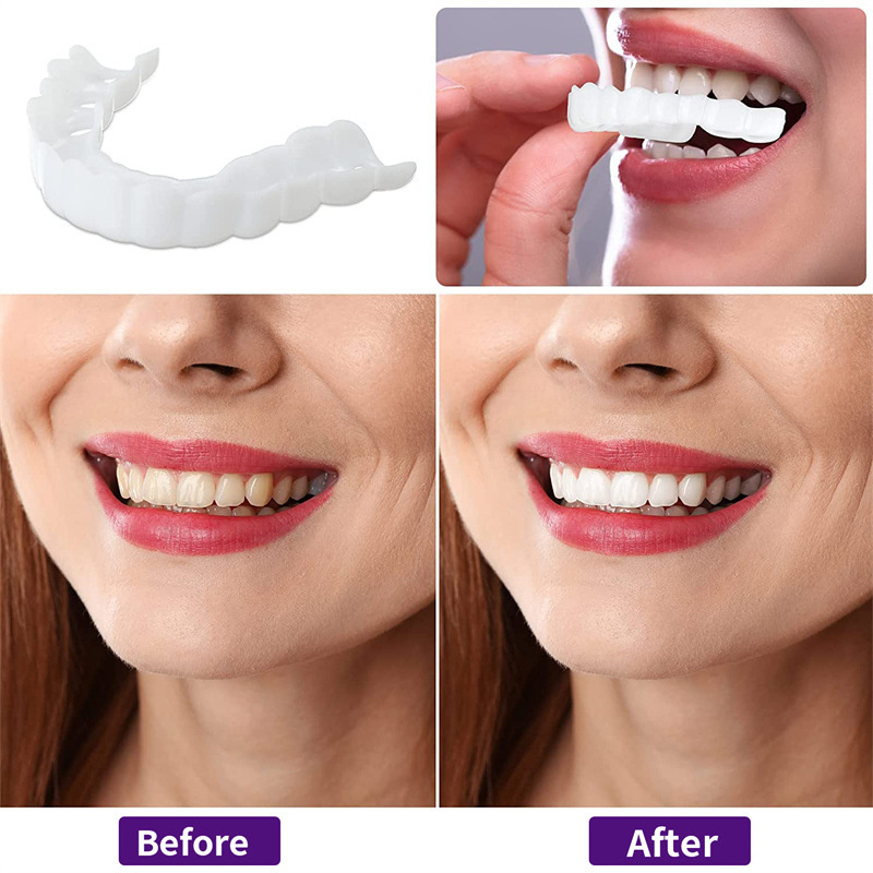 Tooth Veneer Cover Natural Temporary Fake Teeth Top and Bottom Teeth for Men and Women, Cover The Imperfect Teeth,Fix Confident Smile