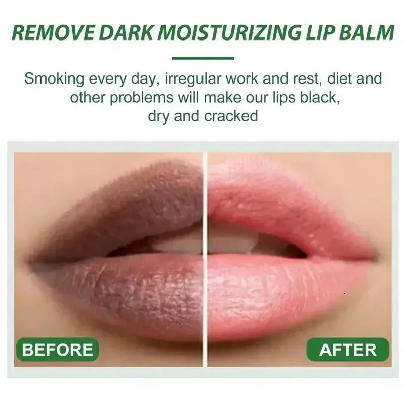 Remove Dark Lip Melanin Mask Gloss Oil Exfoliating Clean Moisturizer Korean Care Products Makeup Beauty Health 241008