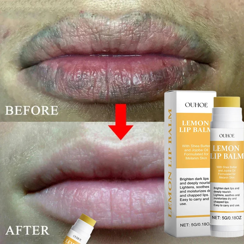 Remove Dark Lip Balm Melanin Wrinkles Gloss Oil Exfoliating Clean Moisturizer Korean Care Beauty Makeup 241008
