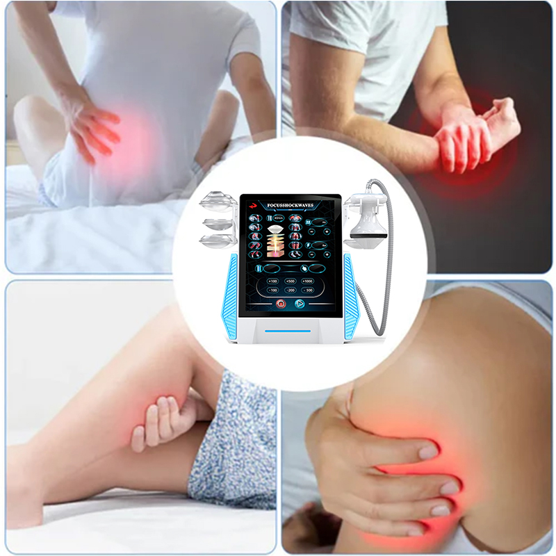 Extracorporeal Focused Shockwave Therapy Machine ESWT Shockwave pain relief Physiotherapy Device