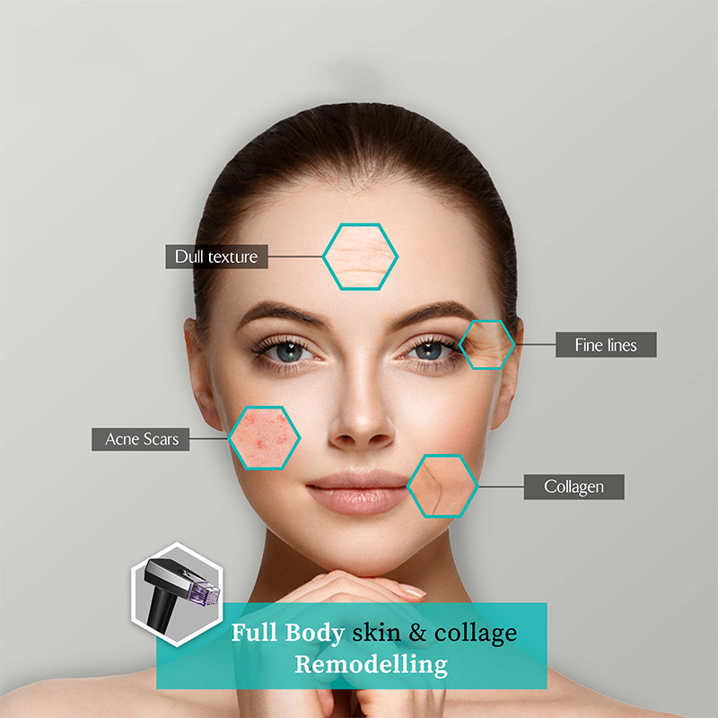 Professional Microneedling Fractional Machine Microneedle Anti Wrinkle Device Fractional Radio Frequency RF Machine Face Lifting Beauty Device