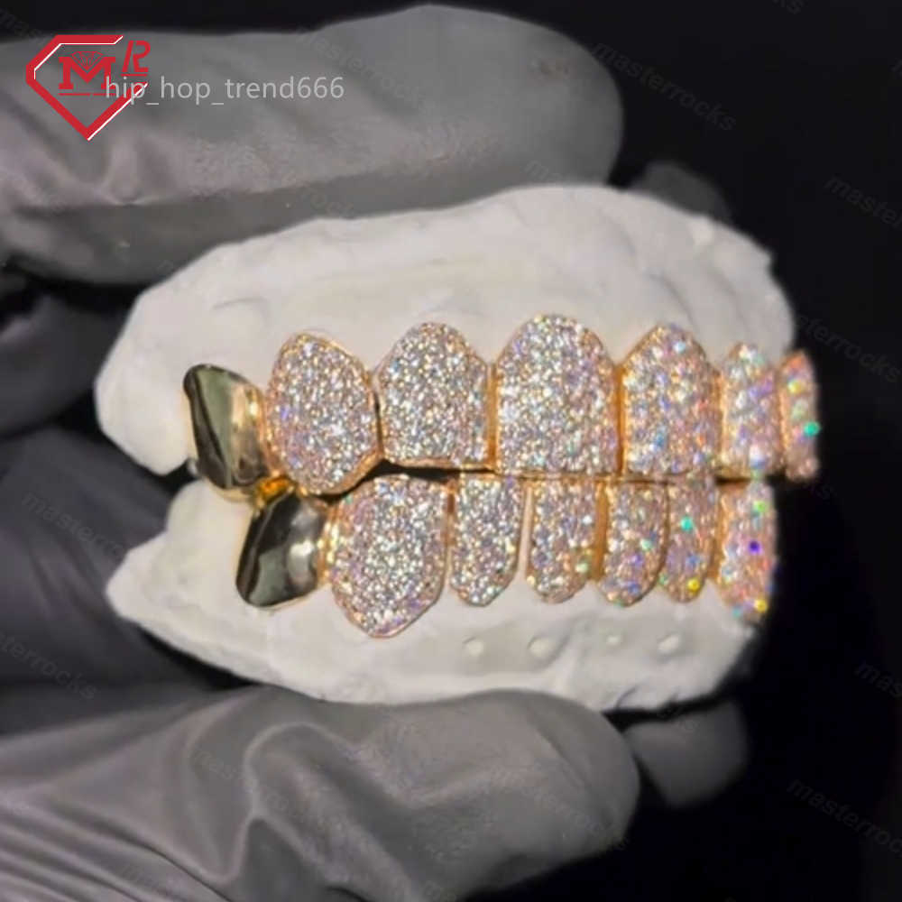 Personalized Hip Hop Dental Grillz 925 Sterling Silver and Yellow Gold Base with Premium Moissanite Gemstones