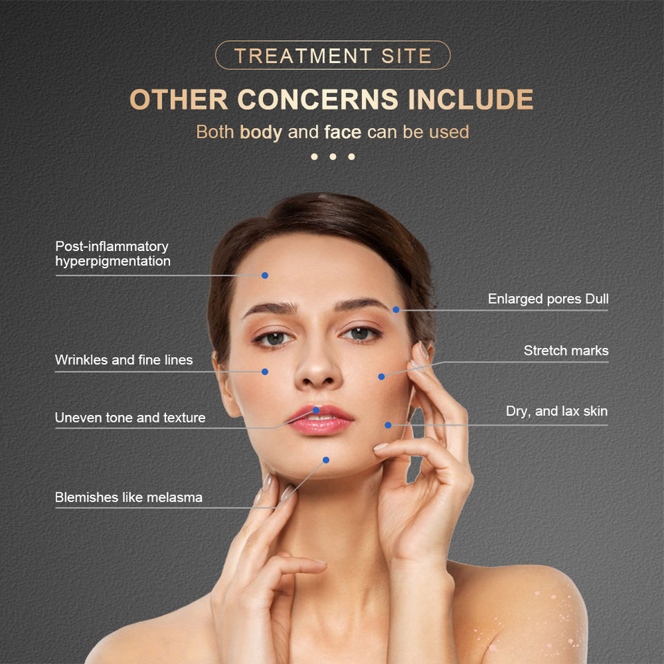 2023 New Arrival virtue rf microneedling machine / rf microneedling machine vacuum