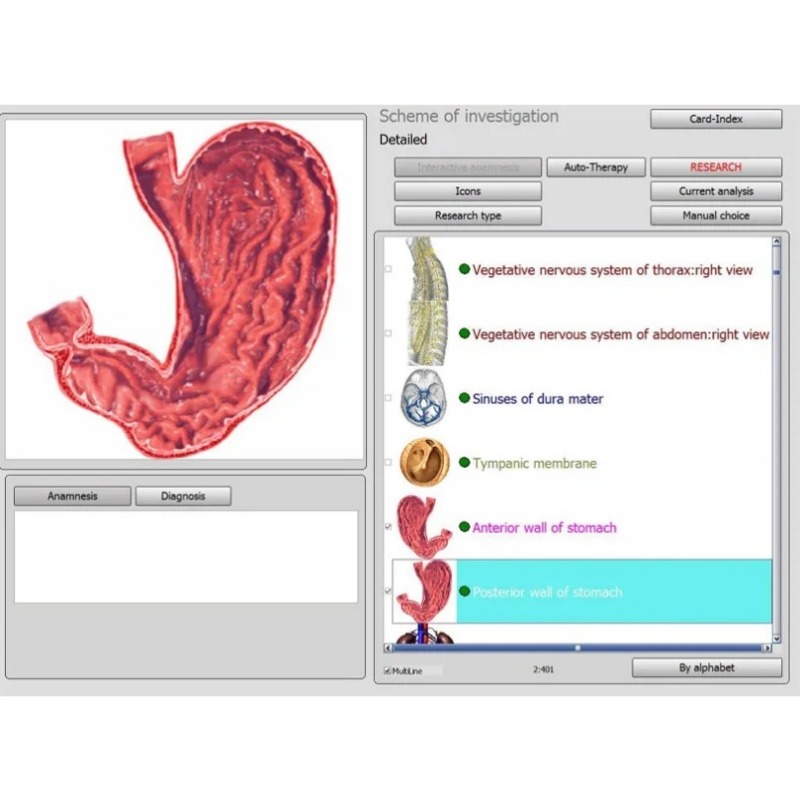 Other Health Care Items Bioplasm 18D NLS Analyzer Non-Linear Analysis System Bioresonance Machine - Aura Chakra Healing On Sale555