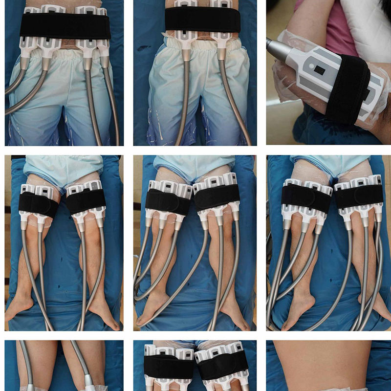 2026 New Arrival 8 Handles Diamond Ice Cold Body Sculpting Cryo Slimming Fat Body Freezing Machine Belly Wrinkles Removal Stretch Marks Removal
